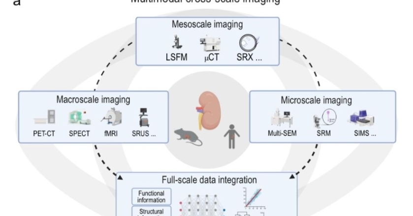 中國科學家計劃打造“數字腎臟” 讓腎臟疾病“清晰可見”