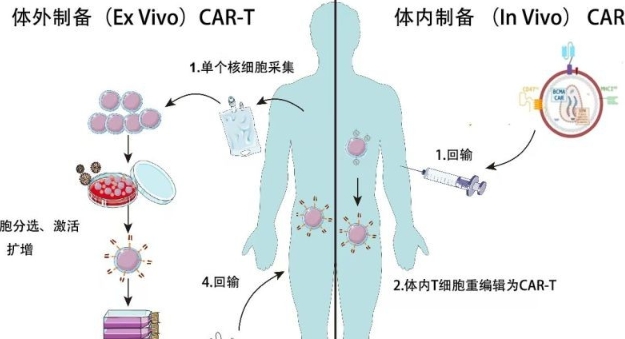 中國取得血液腫瘤細胞療法里程碑式突破